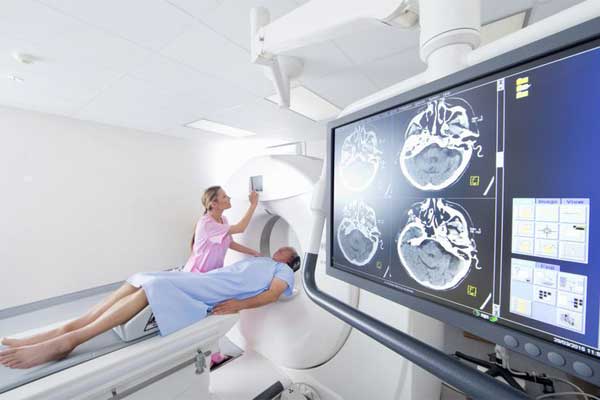 تشخیص سکته مغزی با رادیولوژی