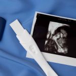 سونوگرافی آنومالی