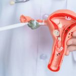 سونوگرافی فولیکول چیست و چه کاربردی در درمان ناباروری دارد؟ ا
